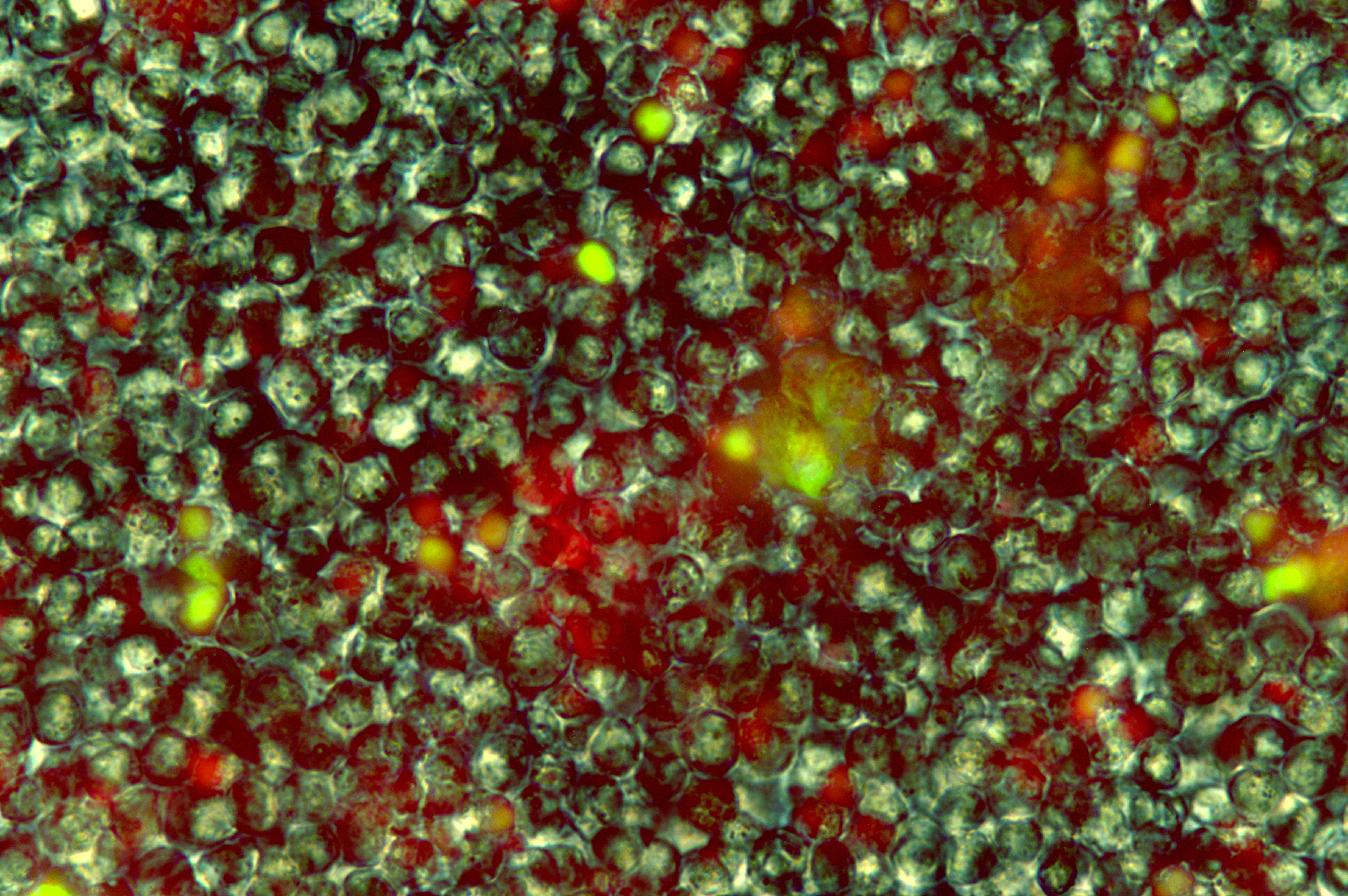 Live cells image (adenocarcinoma + monocytes)